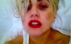 Photo : Lady Gaga et les conséquences de son accident