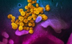 AUDIO - Coronavirus: Un Sénégalais atteint par le coronavirus explique les symptômes