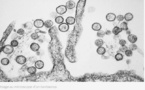 Non, un hantavirus ne va pas déclencher une nouvelle épidémie