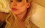 Lady Gaga s'est-elle fait refaire les lèvres ?