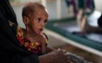 Clôture d’une formation sur la malnutrition sévère aigue, samedi à Thiès