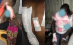 Gueule-Tapée: Une dame ébouillante les filles de sa co-épouse