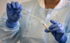 Coronavirus: Le tocilizumab est efficace pour les cas graves, d’après une étude française