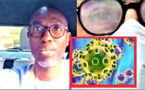 Covid-19 / Port de lunettes: Pr. Moussa Seydi apporte des éclaircissements (VIDEO)