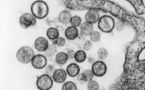 Alerte à l'hantavirus en Californie