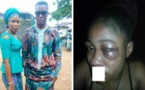 Nigéria: un homme bat son épouse qui refuse un avortement de sa grossesse de 3 mois