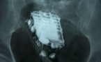 Un détenu trahi par la sonnerie du portable dissimulé dans son corps !