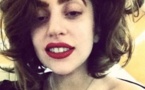 Lady Gaga : blessée, elle annule une partie de ses concerts