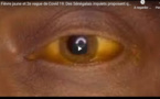 Fièvre jaune et 2e vague de Covid-19: Des Sénégalais inquiets proposent quelques remèdes...