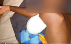 Manifestations de soutien à Ousmane Sonko: L’élève amputé du bras est sorti de l’hôpital