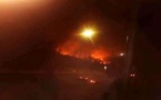 Incendie au service de réanimation de l’hôpital de Saint-Louis
