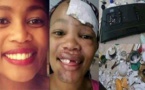 Un homme arrache les dents de sa petite amie avec une pince, pour avoir détruit ses biens