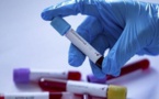 Variant Omicron: Le Sénégal "tient" son premier cas positif (Iressef)