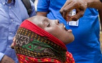 Santé - Poliovirus de type 2 : 18 cas de paralysie enregistrés au Sénégal en 2021