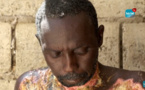 Guédiawaye / Grièvement brûlé, Babacar se meurt à petit feu (Ames sensibles s'abstenir)