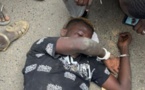Sacré-Coeur 2 : La moto des agresseurs percutée par un taximan, l'un d'eux lynché