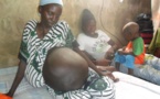 Photos - Comment Ndoye Bane a sauvé cette femme atteinte d'une étonnante maladie