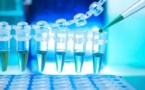  Santé : L'obésité grignote du terrain en Afrique
