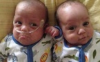 Des jumeaux nés à 39 jours d'intervalle