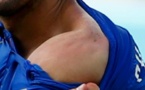 Suarez a encore mordu un adversaire !