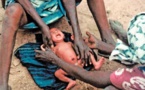 Excision : Une pratique qui tend à disparaître mais encore présente au Sénégal
