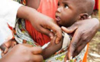 Malnutrition : Plus de 109.000 enfants dépistés trimestriellement à Kolda