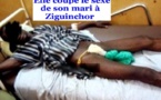 Ziguinchor : Une jeune mariée sectionne le sexe de son époux