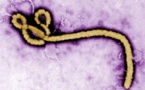 Alerte: Un échantillon de virus Ebola volé en Guinée