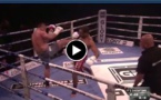 Impressionnante fracture du nez lors d’un match de kickboxing