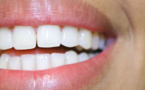 Le détartrage : Un soin indispensable à la santé de nos dents