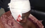 Horreur à Thiaroye Azur : Une  vieille poignardée dans sa chambre par une bande d'agresseurs (Vidéo)