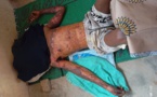 Emigration clandestine-Algérie : Des sénégalais attaqués au cocktail Molotov et au couteau !  (Âmes sensibles s’abstenir HSF)