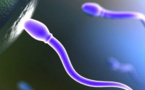 La qualité du sperme est un bon marqueur de l'état de santé