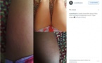 Oui, la cellulite et les vergetures, c'est NORMAL ! Cette nouvelle tendance sur le web est en train de décomplexer enfin toutes les femmes...