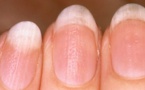 Ce que vos ongles révèlent sur votre santé