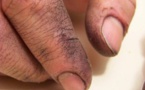 Un recruteur lui demande de laver les mains de son père lors d'un entretien d'embauche... Ce qu'il a dit ensuite m'a mis les larmes aux yeux !