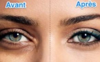 7 astuces naturelles anticernes
