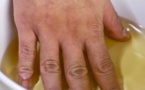 Cette recette soulage l’arthrite et les douleurs articulaires naturellement