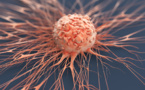 Cancers : 8 500 décès recensés parmi les 12 000 nouveaux cas diagnostiqués par an, selon la présidente de la LISCA