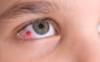 9 Signes que vous avez un problème aux yeux