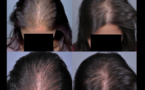 Pour des cheveux qui poussent rapidement, essayez le secret des Indiennes !