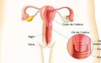 Voici comment prévenir le cancer du col de l’utérus ?