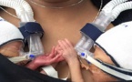 Deux minuscules bébés, nés prématurément, refusent de se lâcher la main... Magnifique !