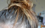 3 problèmes de cheveux qui indiquent des problèmes de santé