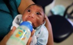 Bébés malformés: et si Zika n'était pas en cause?