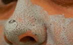 Débarrassez-vous des points noirs et des imperfections avec cet incroyable remède maison