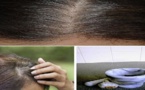 5 minutes pour vous débarrasser des cheveux blancs et faire repousser vos cheveux naturellement