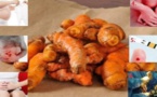 Attention ! Arrêtez de consommer du curcuma si vous faites partie d’une de ces 5 catégories de personnes