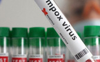 Mpox au Sénégal : Le seul patient recensé est totalement guéri, plus de cas actif de Mpox, vigilance maintenue par le ministère