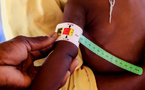 La malnutrition provoque une forme distincte de diabète, concluent des experts mondiaux